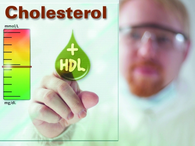 p2 HDL Cholesterol HL1707 ts469522879